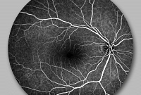 Augenarztpraxis Karsta Rehfeldt  - Augenhintergrund Angiographie
